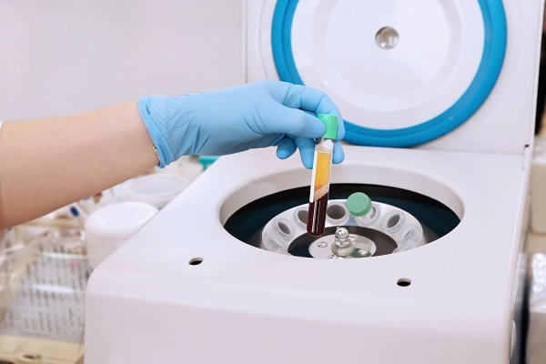Technician takes blood out of a centrifuge