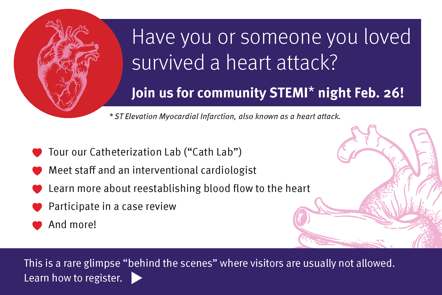 HVCI-2690_Design_STEMI_Postcard_9x6_FINAL (2)_Page_1