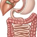 SleeveGastrectomy