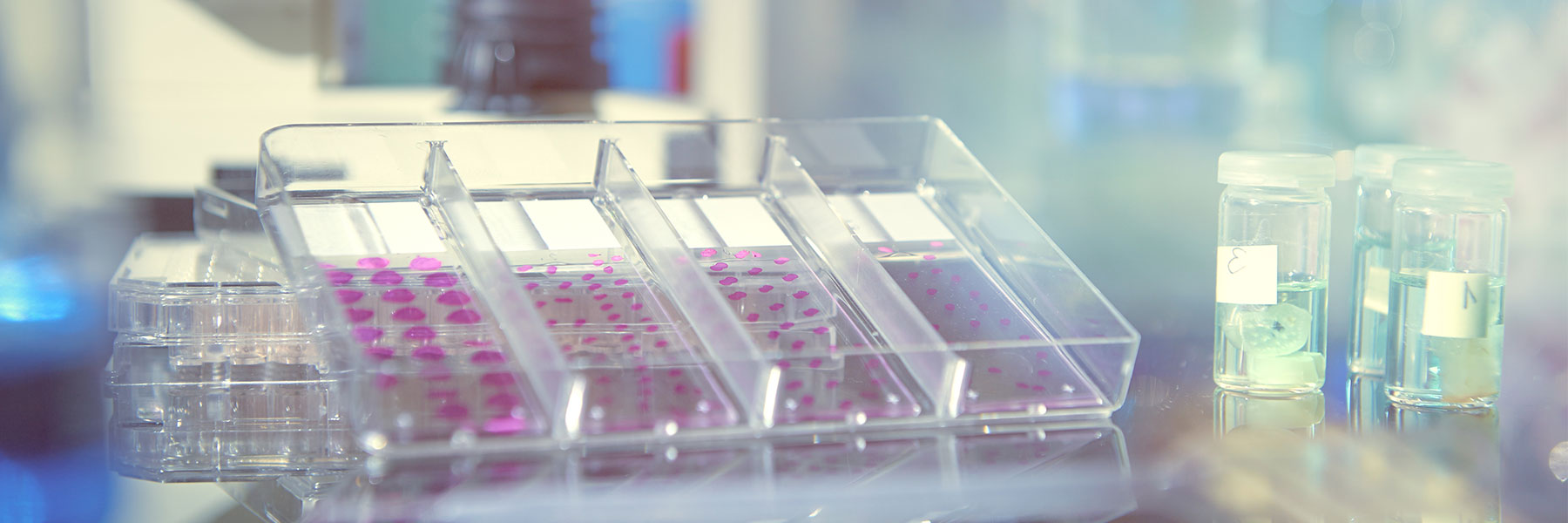 Laboratoryscreeningprocess