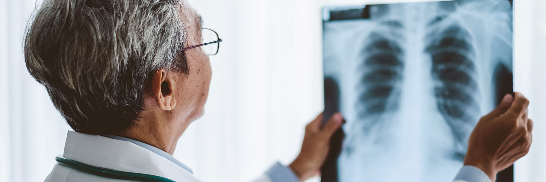 Physicianinspectsachestx-ray