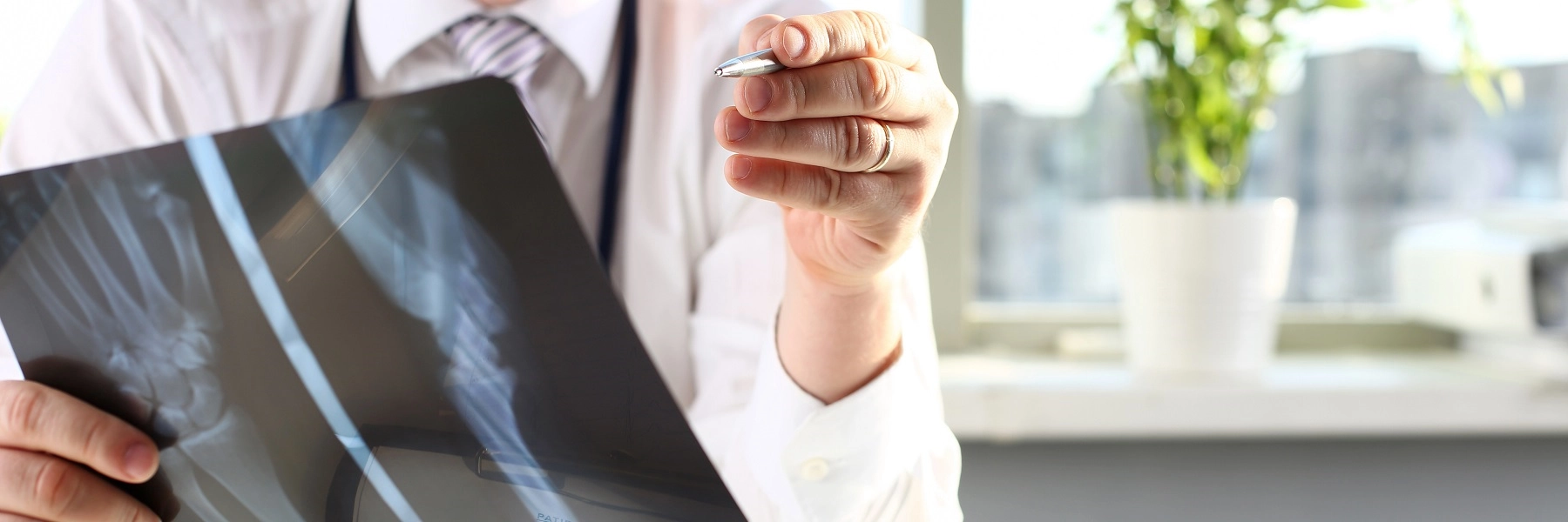 Imageshowshandsholdinganx-rayfilmofawrist