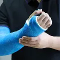 Closeupofamansarmwearingabluecastfromhandtohumerus