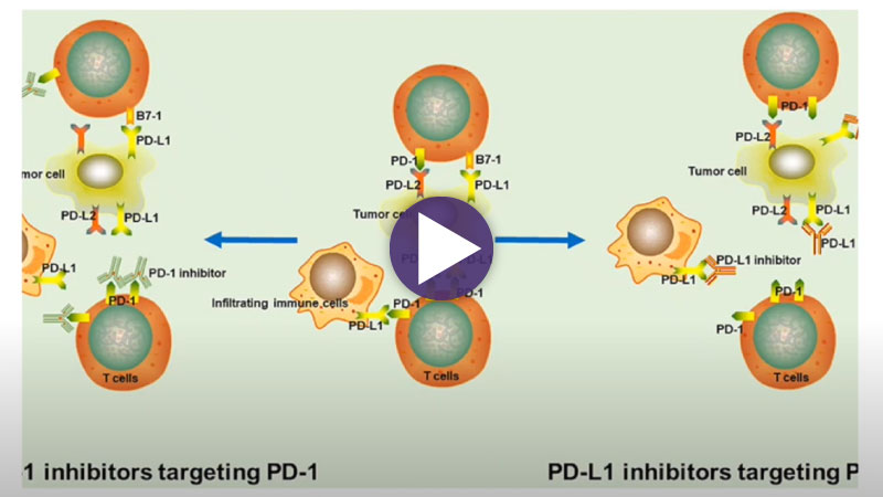 cancer-lung-thumbnail-2-23