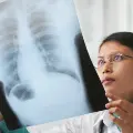 Doctorexaminingx-rayofapatientslungs