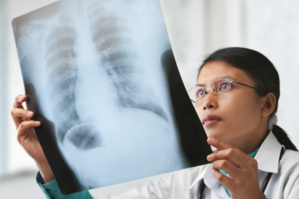Doctor examining x-ray of a patient's lungs.