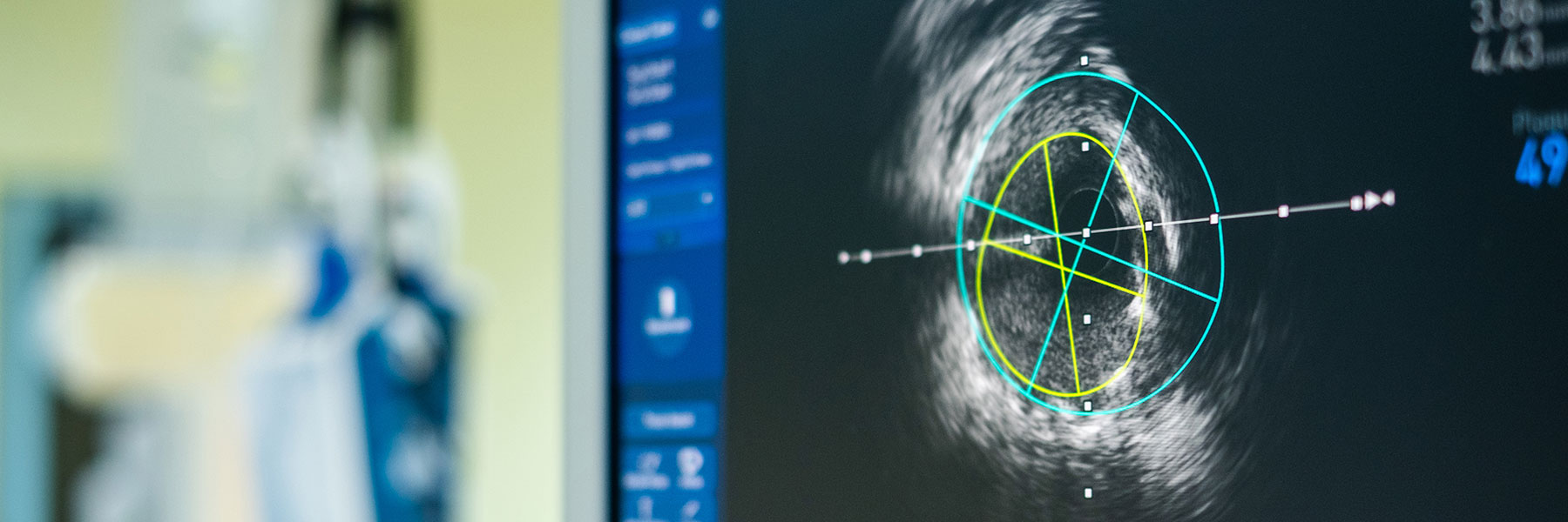 Vascularimagingtechnology