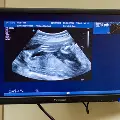 Ultrasound-05-021116-inCopy-2
