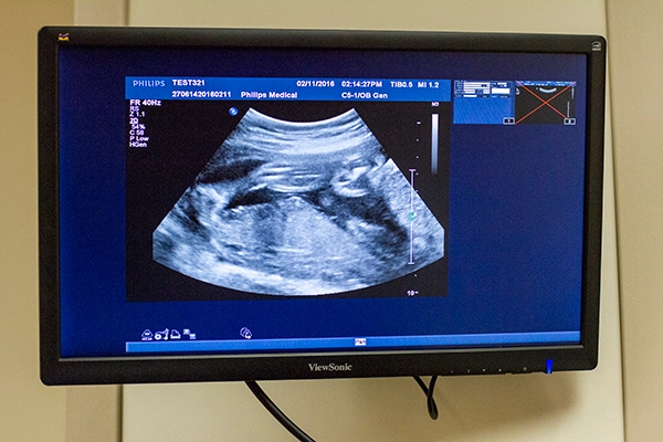 Ultrasound-05-021116-inCopy-2