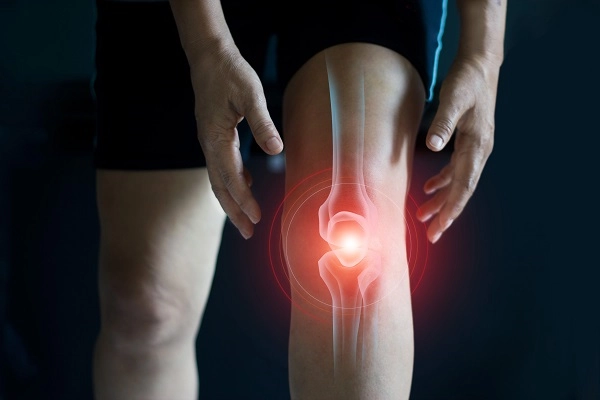 photo illustration of a knee joint radiating pain