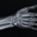 X-rayofthehandandwrist