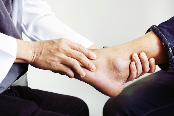 Orthopedic specialist examining an ankle