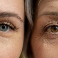 Aclose-upcomparisonoftheeyesofayoungwomanandanolderwomanhighlightingthevisibledifferencesinskintextureandwrinkles