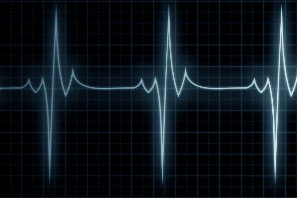 heartbeat EKG