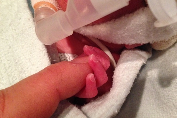 MOD NICU tiny hand MOD NICU tiny hand
