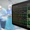 EKGmachinerecordsheartrhythmsinanoperatingroom